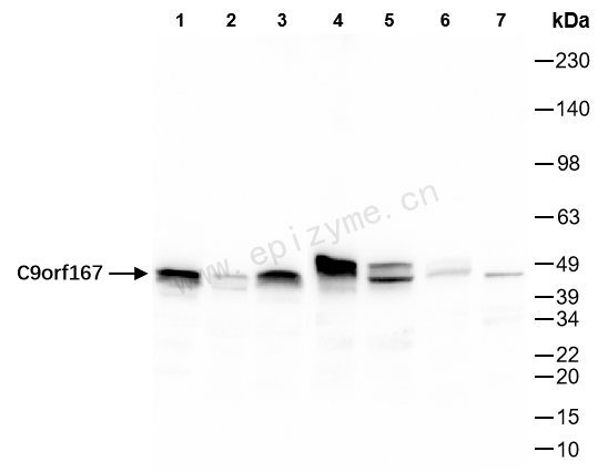 Anti-TOR4A Rabbit mAb [24K75M12]
