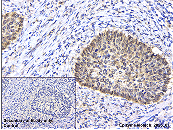 Anti-GSDME Rabbit mAb [85K48L39]
