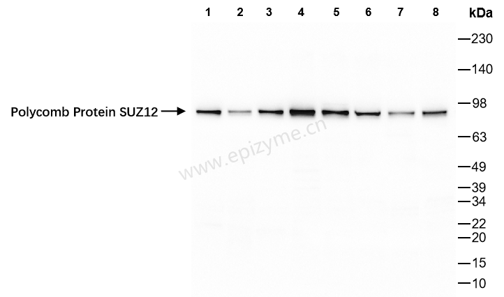 Anti-Polycomb Protein SUZ12 Rabbit mAb [25K29M31]