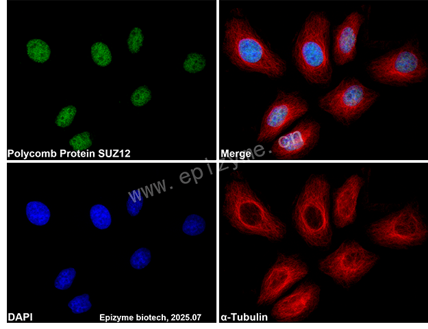 Anti-Polycomb Protein SUZ12 Rabbit mAb [25K29M31]