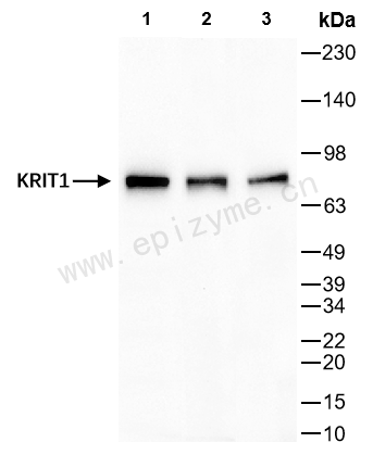 Anti-KRIT1 Rabbit mAb [36M96K43]