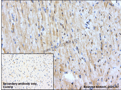 Anti-KRIT1 Rabbit mAb [36M96K43]
