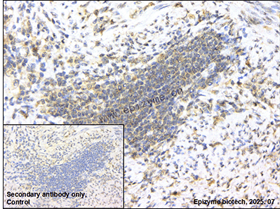 Anti-KRIT1 Rabbit mAb [36M96K43]
