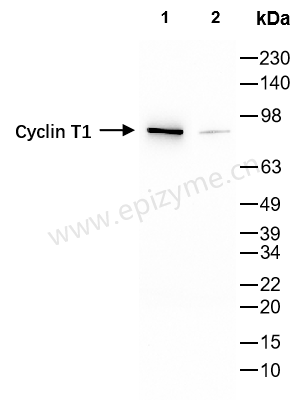 Anti-Cyclin T1 Rabbit mAb [65K72M52]