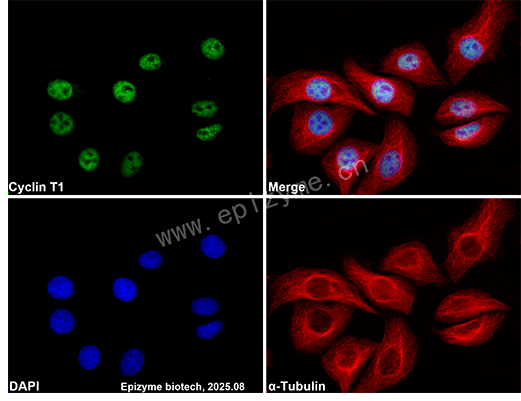 Anti-Cyclin T1 Rabbit mAb [65K72M52]