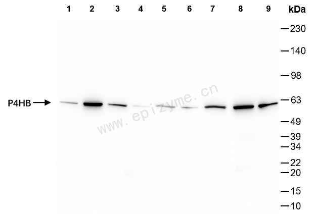 Anti-PDIA1 (PDI) Rabbit mAb [80L85K18]
