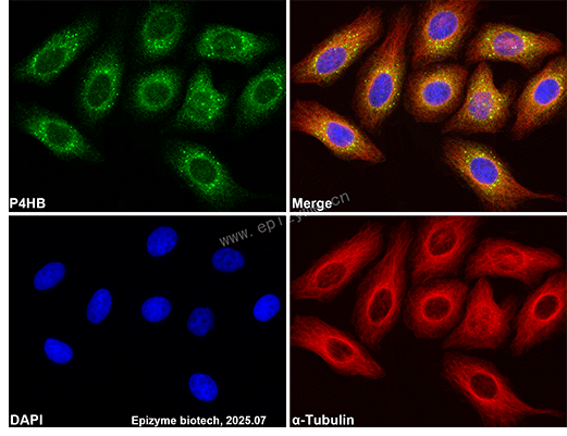 Anti-PDIA1 (PDI) Rabbit mAb [80L85K18]