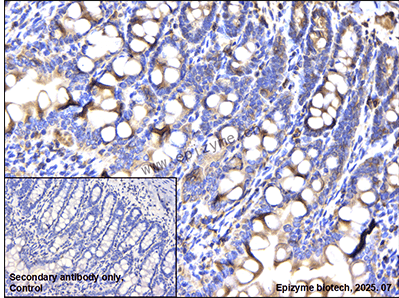 Anti-PDIA1 (PDI) Rabbit mAb [80L85K18]