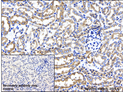 Anti-PDIA1 (PDI) Rabbit mAb [80L85K18]