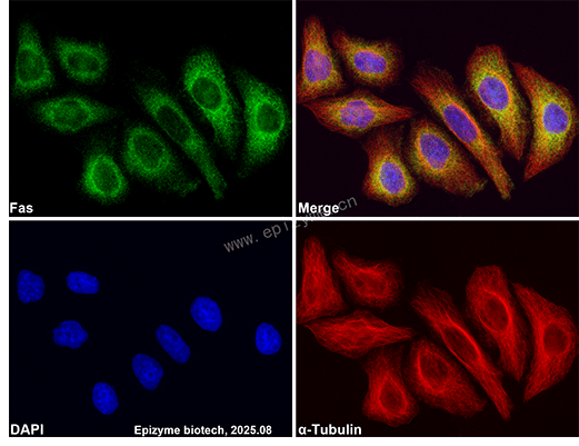 Anti-Fas/CD95 Rabbit mAb [17M85L89]
