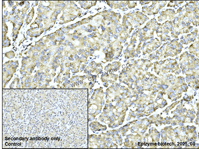 Anti-Fas/CD95 Rabbit mAb [17M85L89]