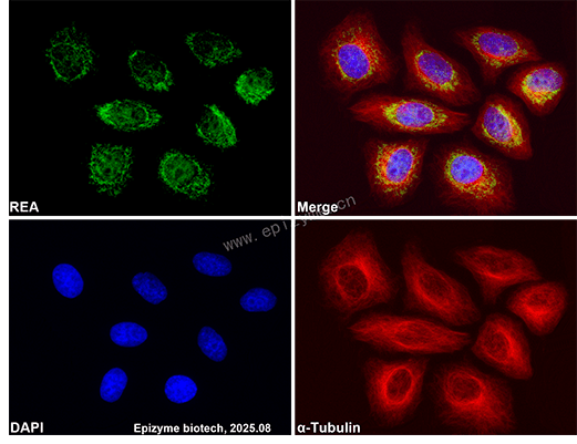 Anti-REA Rabbit mAb [55K24K18]
