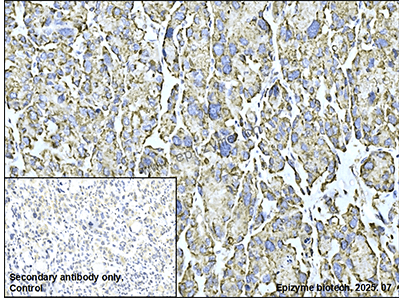 Anti-REA Rabbit mAb [55K24K18]