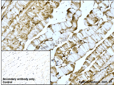 Anti-REA Rabbit mAb [55K24K18]