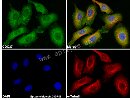 Anti-CDC37 Rabbit mAb [85K80L49]