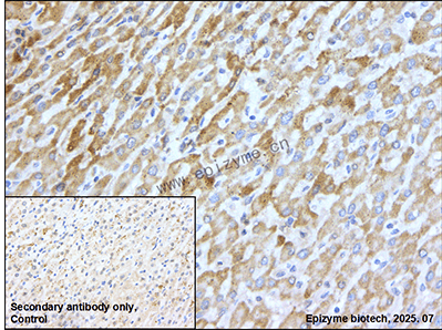Anti-N WASP Rabbit mAb [52K66M54]