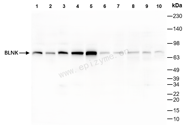 Anti-BLNK Rabbit mAb [58M49M72]