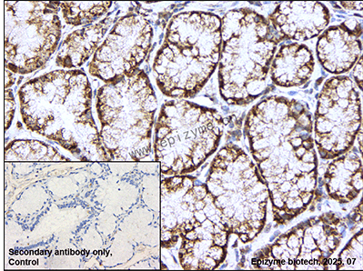 Anti-BLNK Rabbit mAb [58M49M72]