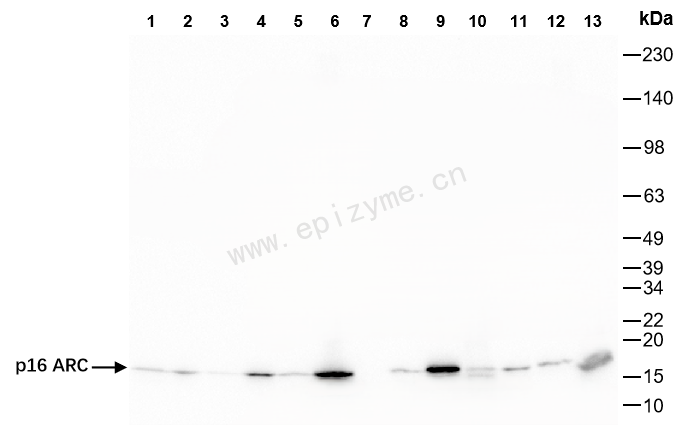 Anti-p16 ARC Rabbit mAb [92K31M18]