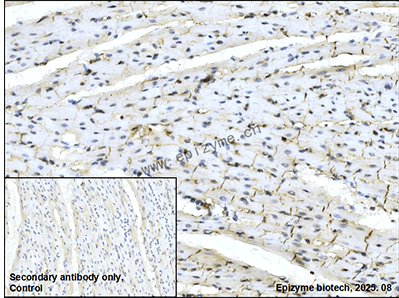 Anti-p16 ARC Rabbit mAb [92K31M18]