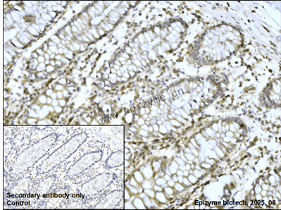 Anti-p16 ARC Rabbit mAb [92K31M18]
