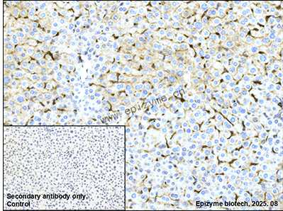 Anti-p16 ARC Rabbit mAb [92K31M18]