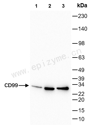 Anti-CD99 Rabbit mAb [33M61K65]