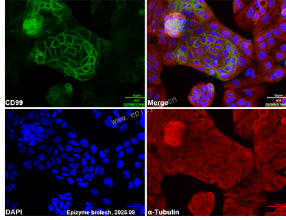 Anti-CD99 Rabbit mAb [33M61K65]