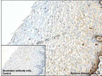 Anti-CD99 Rabbit mAb [33M61K65]