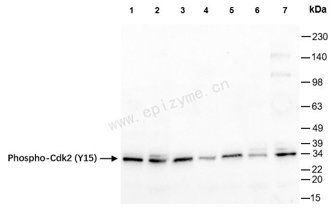 Anti-Phospho-CDK2 (Tyr15) Rabbit mAb [89R47D08]