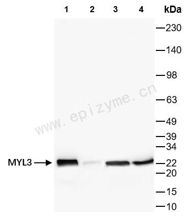 Anti-Myosin light chain 3 Rabbit mAb [95A83Q84]