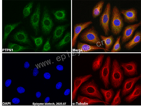 Anti-PTP1B Rabbit mAb [99P95D79]