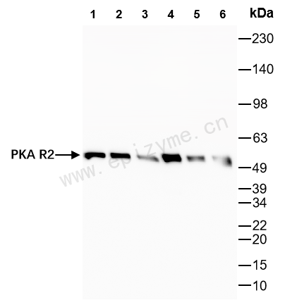 Anti-PKA RII alpha Rabbit mAb [25A58T07]