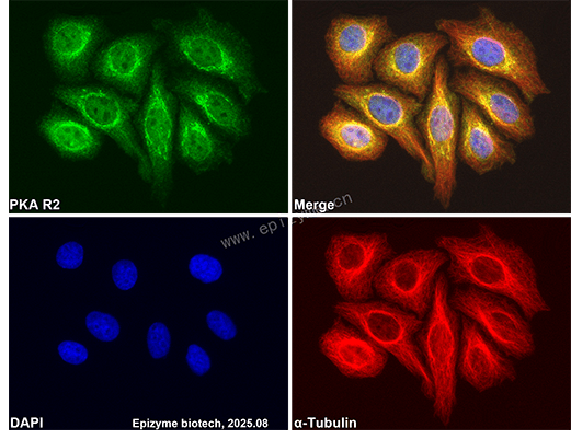 Anti-PKA RII alpha Rabbit mAb [25A58T07]