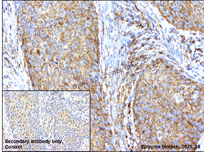 Anti-PKA RII alpha Rabbit mAb [25A58T07]