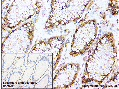 Anti-PKA RII alpha Rabbit mAb [25A58T07]