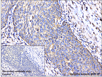 Anti-GSDMC Rabbit mAb [46T04L85]