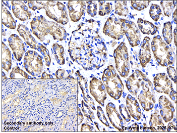 Anti-GSDMC Rabbit mAb [46T04L85]