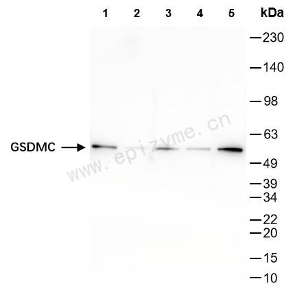 Anti-GSDMC Rabbit mAb [46T04L85]