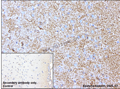 Anti-COX5A Rabbit mAb [72T07L77]