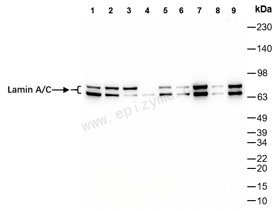 Anti-Lamin A/C Rabbit mAb [62C12A32]