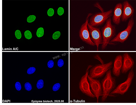 Anti-Lamin A/C Rabbit mAb [62C12A32]