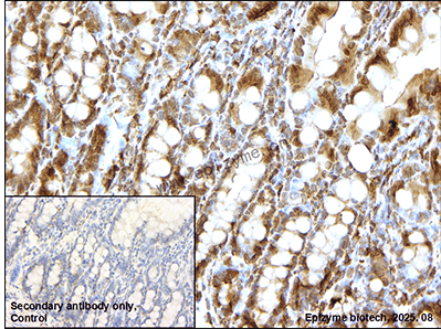 Anti-Lamin A/C Rabbit mAb [62C12A32]