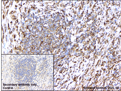 Anti-Lamin A/C Rabbit mAb [62C12A32]