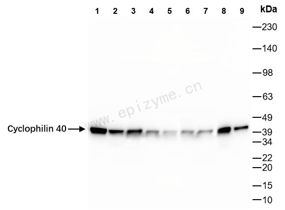 Anti-Cyclophilin 40 Rabbit mAb [39B66E99]