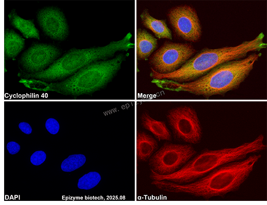 Anti-Cyclophilin 40 Rabbit mAb [39B66E99]