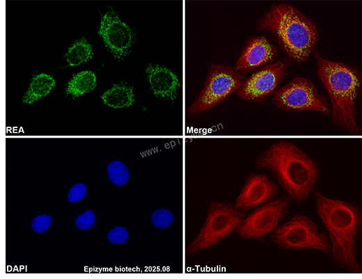 Anti-REA Rabbit mAb [92B40S75]