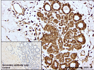 Anti-REA Rabbit mAb [92B40S75]