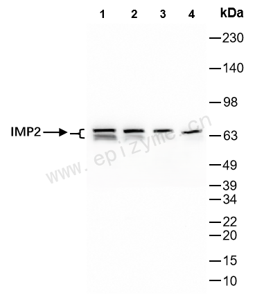 Anti-IGF2BP2/IMP-2 Rabbit mAb [84K59B64]
