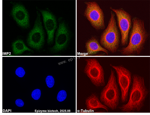 Anti-IGF2BP2/IMP-2 Rabbit mAb [84K59B64]